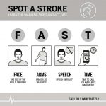 Signs of a Stroke