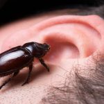 How-to-Remove-a-Bug-from-Your-Ear