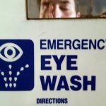 What-You-Should-Do-When-Dangerous-Chemicals-Splash-in-Your-Eye